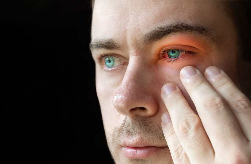 A man with blepharitis touches his face near his red and irritated eye.